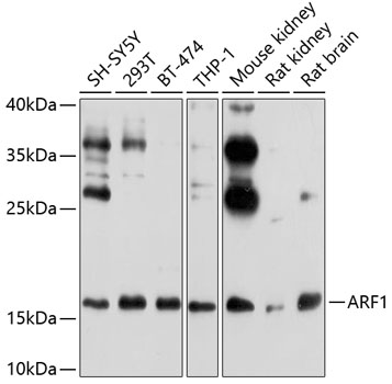 ARF1 Polyclonal Antibody