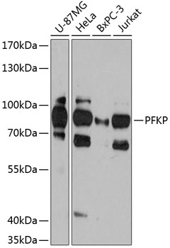 PFKP Polyclonal Antibody
