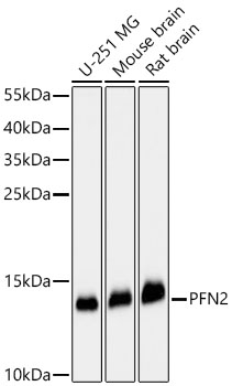 PFN2 Polyclonal Antibody
