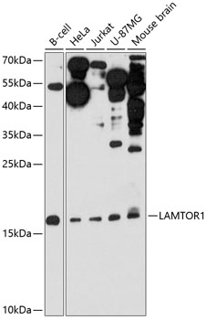 LAMTOR1 Polyclonal Antibody