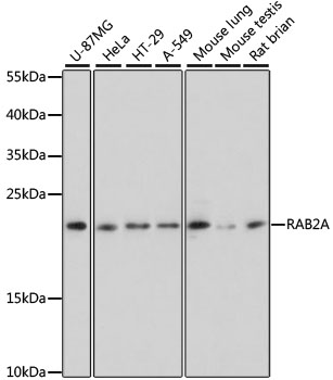 RAB2A Polyclonal Antibody