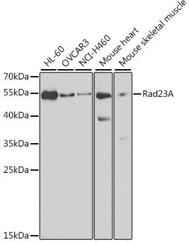 Rad23A Polyclonal Antibody
