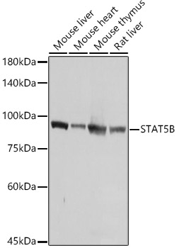 STAT5B Polyclonal Antibody