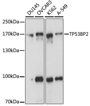 TP53BP2 Polyclonal Antibody