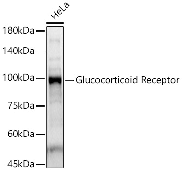 Glucocorticoid Receptor Polyclonal Antibody