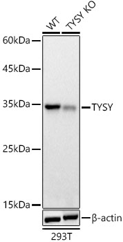 TYSY Polyclonal Antibody