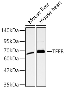 TFEB Polyclonal Antibody