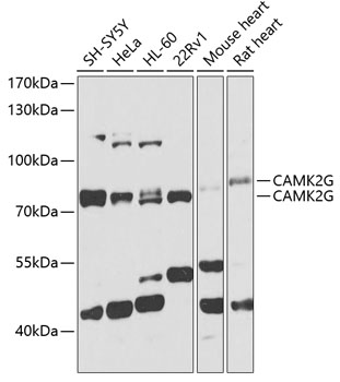 CAMK2G Polyclonal Antibody