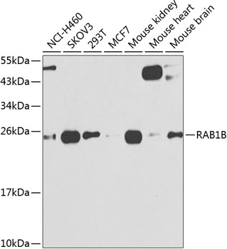 RAB1B Polyclonal Antibody