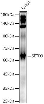 SETD3 Polyclonal Antibody