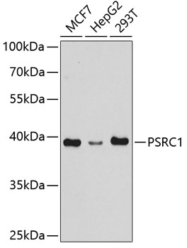 PSRC1 Polyclonal Antibody