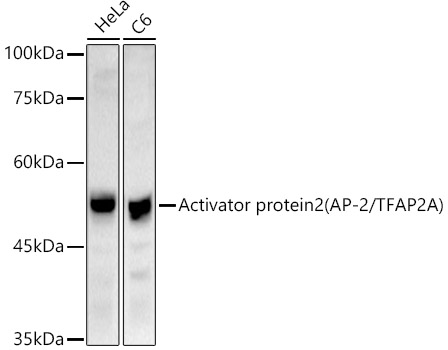 Activator protein 2 (AP-2/TFAP2A) Polyclonal Antibody&nbsp;<img src="images/icon_newarrival.gif" alt="new" border="0">
