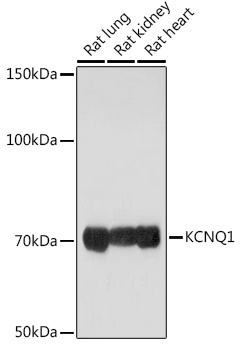 KCNQ1 Polyclonal Antibody