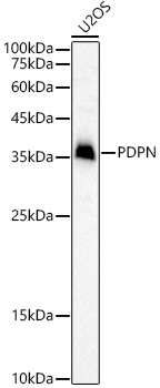 Podoplanin Polyclonal Antibody