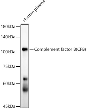 Complement factor B (CFB) Monoclonal Antibody [6D3N9]