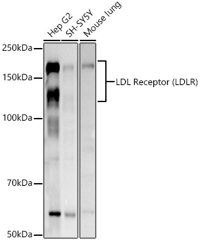 LDL Receptor (LDLR) Polyclonal Antibody