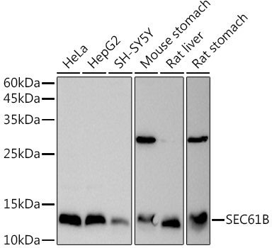 SEC61B Polyclonal Antibody