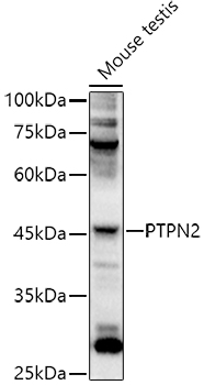 PTPN2 Polyclonal Antibody