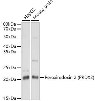 Peroxiredoxin 2 (PRDX2) Polyclonal Antibody