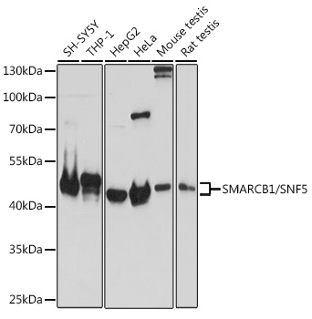 SMARCB1/SNF5 Polyclonal Antibody