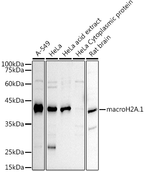 macroH2A.1 Polyclonal Antibody