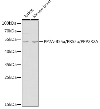 PP2A-B55a/PR55a/PPP2R2A Polyclonal Antibody