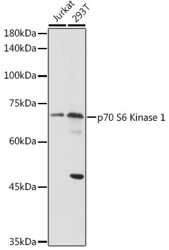 p70 S6 Kinase 1 Polyclonal Antibody