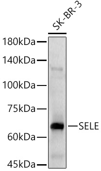 SELE Polyclonal Antibody