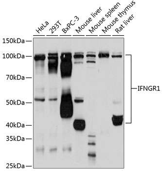 IFNGR1 Monoclonal Antibody [5L7L2]