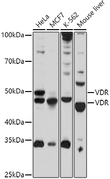 VDR Polyclonal Antibody