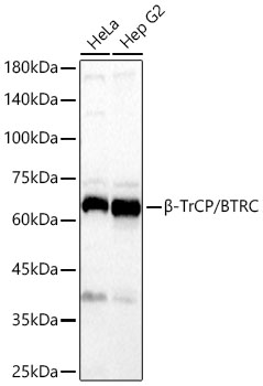 B-TrCP/BTRC Monoclonal Antibody [2Z4D4]