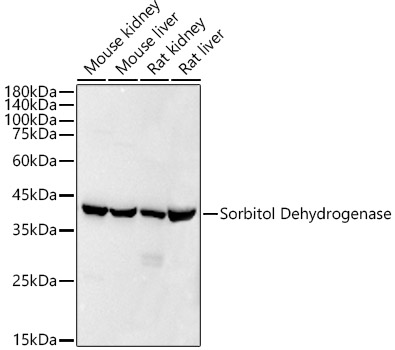 Sorbitol Dehydrogenase Monoclonal Antibody [9Q3B10]