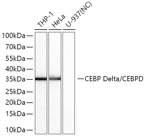 CEBP Delta/CEBPD Monoclonal Antibody [2O1A6]