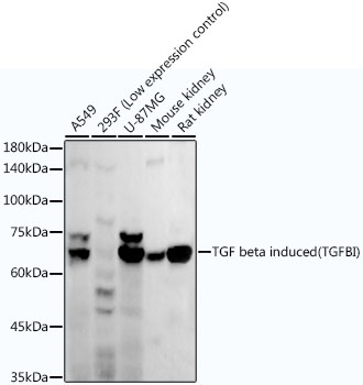 TGF beta induced (TGFBI) Monoclonal Antibody [10C8Y4]