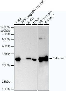Calretinin Monoclonal Antibody [4Q7Z10]