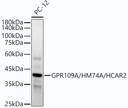 GPR109A/HM74A/HCAR2 Monoclonal Antibody [7A3F2]