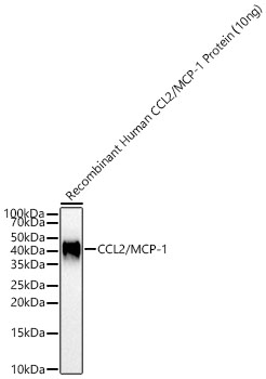 CCL2/MCP-1 Polyclonal Antibody