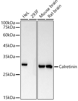 Calretinin Monoclonal Antibody [3B4N7]