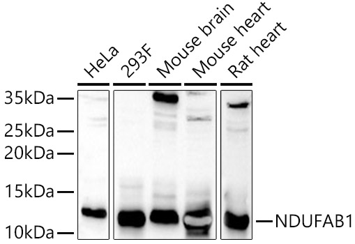NDUFAB1 Polyclonal Antibody