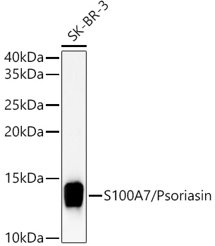 S100A7/Psoriasin Polyclonal Antibody