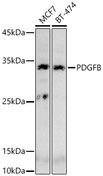 PDGFB Monoclonal Antibody [10D7G7]