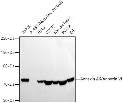 Annexin A6/Annexin VI Monoclonal Antibody [5R9U6]