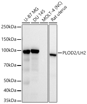 PLOD2/LH2 Monoclonal Antibody [4E3L3]