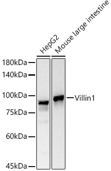 Villin Monoclonal Antibody [8B3M10]