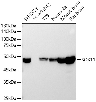 SOX11 Monoclonal Antibody [5K1J5]