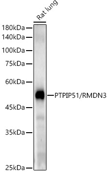 PTPIP51/RMDN3 Monoclonal Antibody [5H6A5]