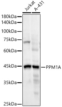 PPM1A Monoclonal Antibody [4C5S5]