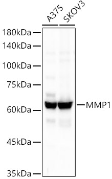 MMP1 Monoclonal Antibody [3C10S1]