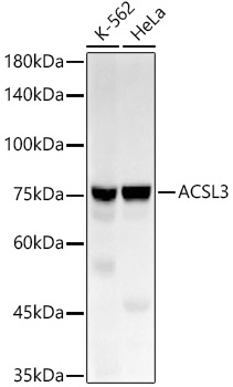 ACSL3 Monoclonal Antibody [4P1J2]&nbsp;<img src="images/icon_newarrival.gif" alt="new" border="0">