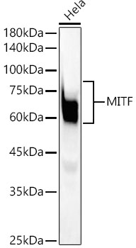MITF Monoclonal Antibody [6S9G4]